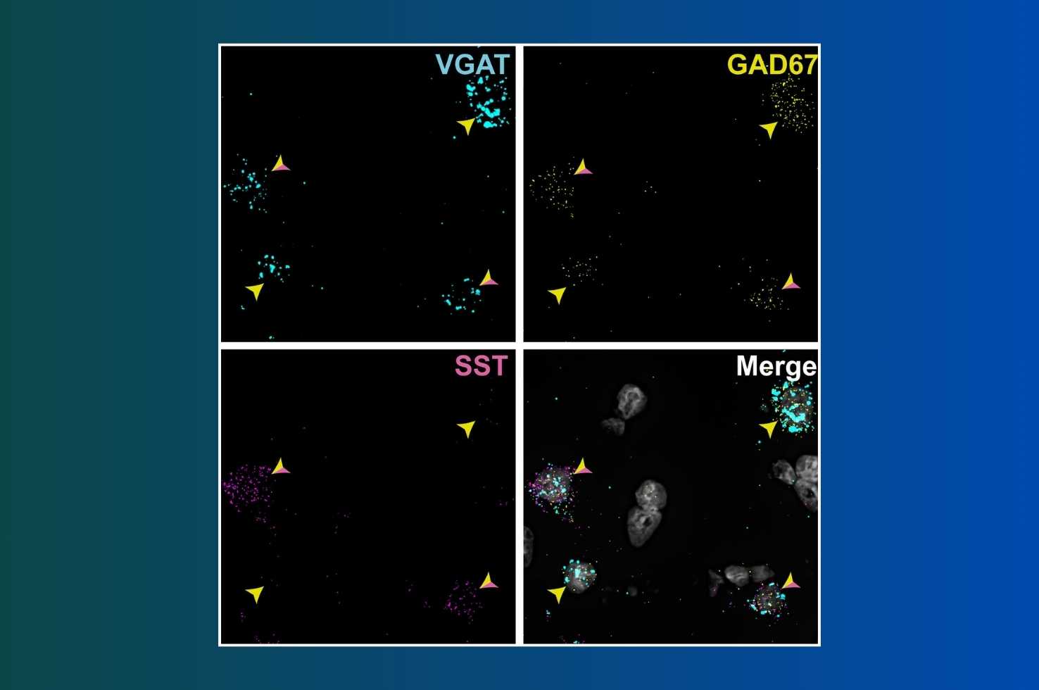 Biological Psychiatry – Alterations in Prefrontal Cortical